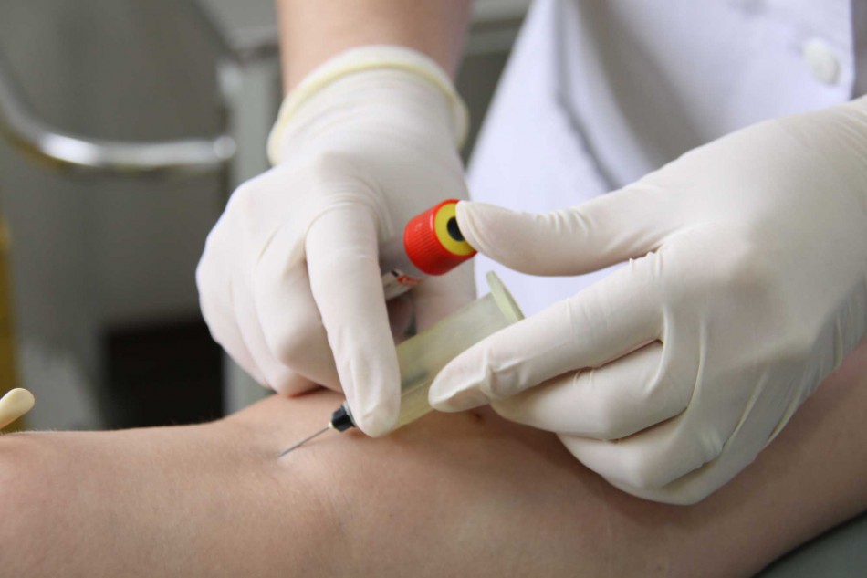Cedap realiza ação de testagem no Dia Mundial de Luta Contra a Aids